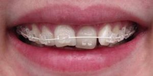 Orthodontics3